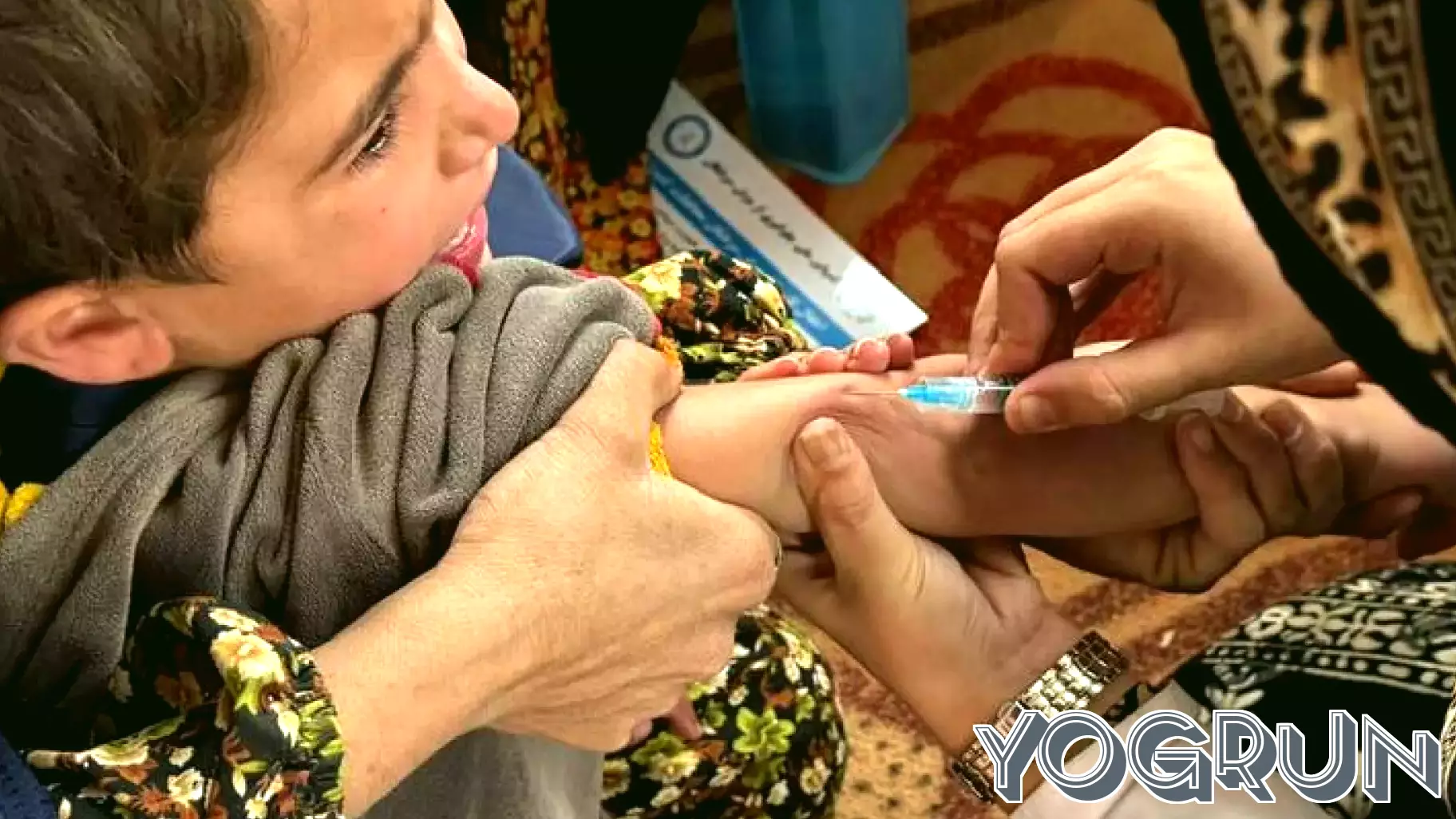 Alarming Rise in Measles Cases as Millions of Children Miss Vaccinations