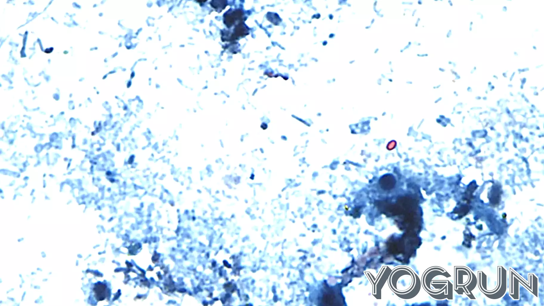 Does cooking or vinegar kill Cyclospora? How to avoid the diarrhea-causing parasite, according to health officials