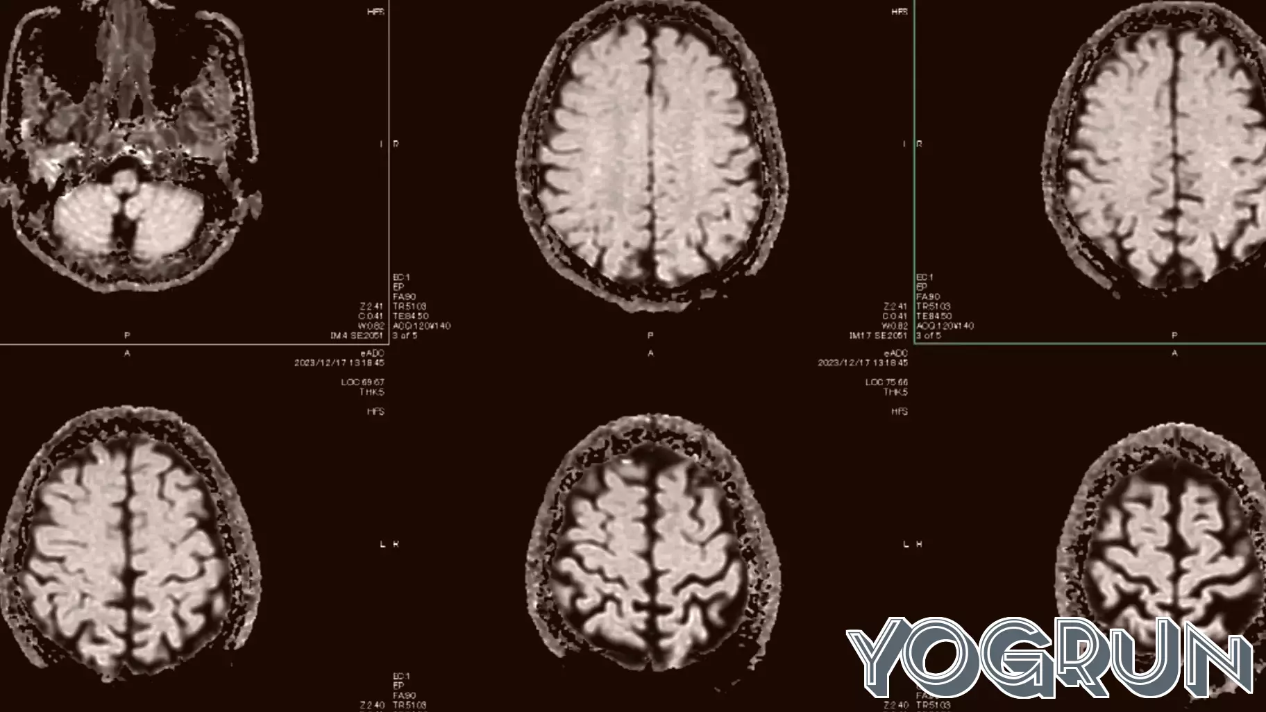 Healthcare Is AI’s Hardest Test