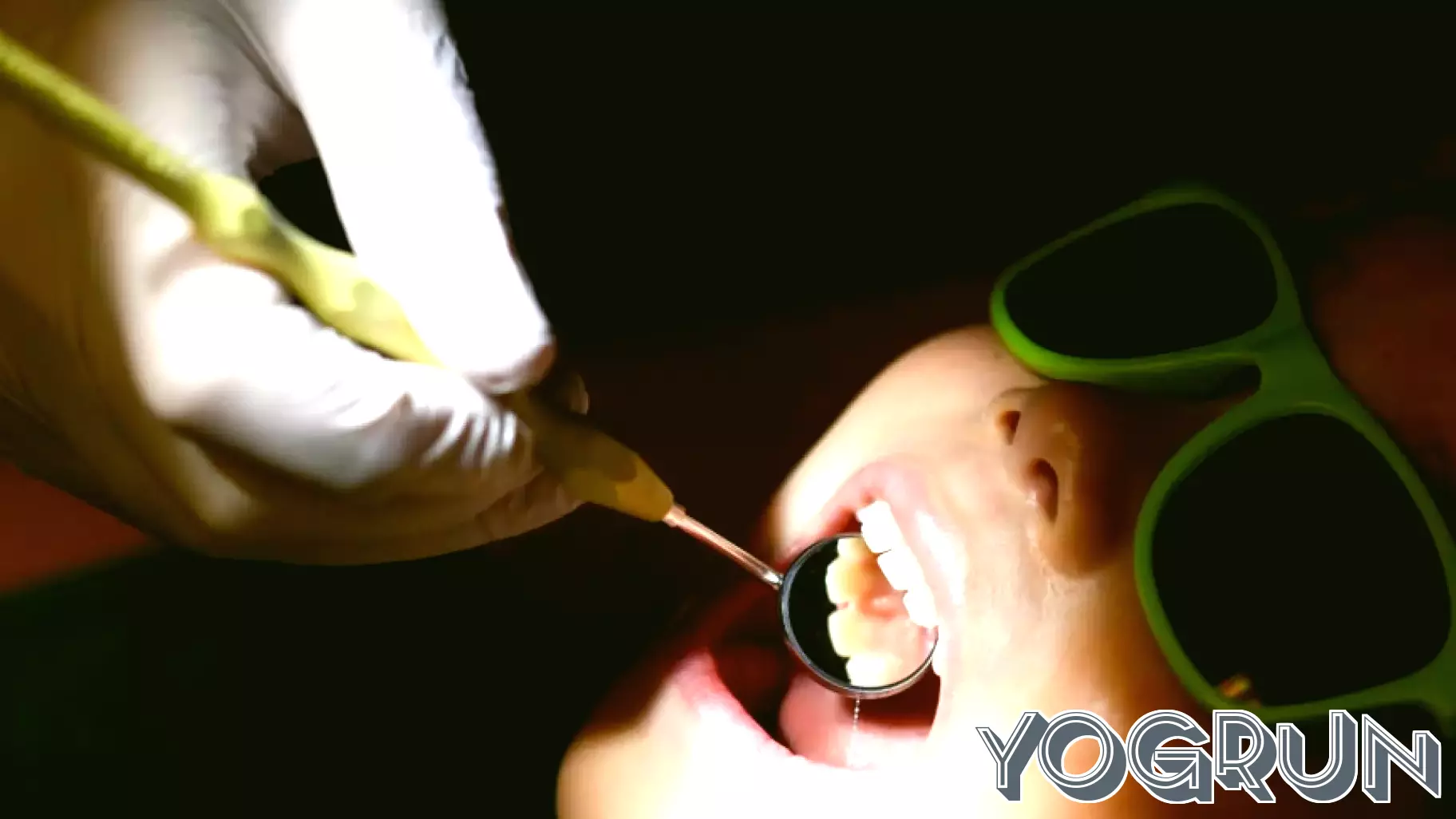 If states ban fluoride, kids with cavities and Medicaid costs could spike, study finds