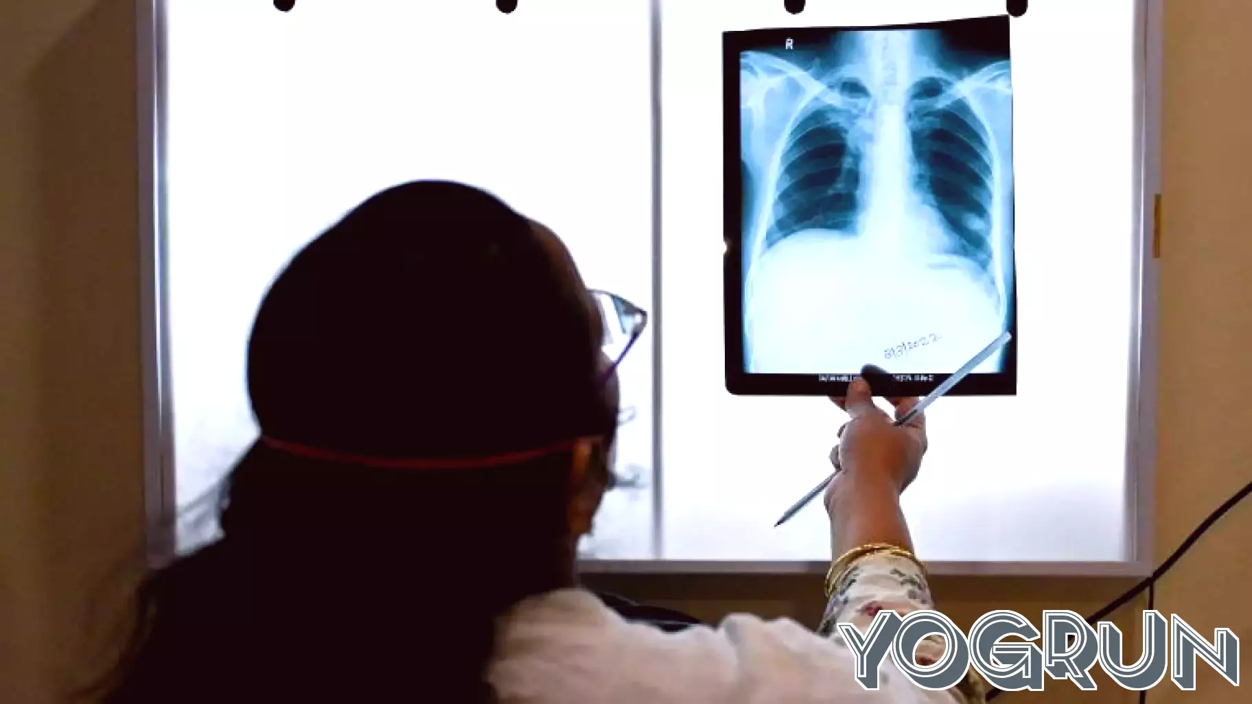 India Faces Challenges in Tuberculosis Elimination Efforts