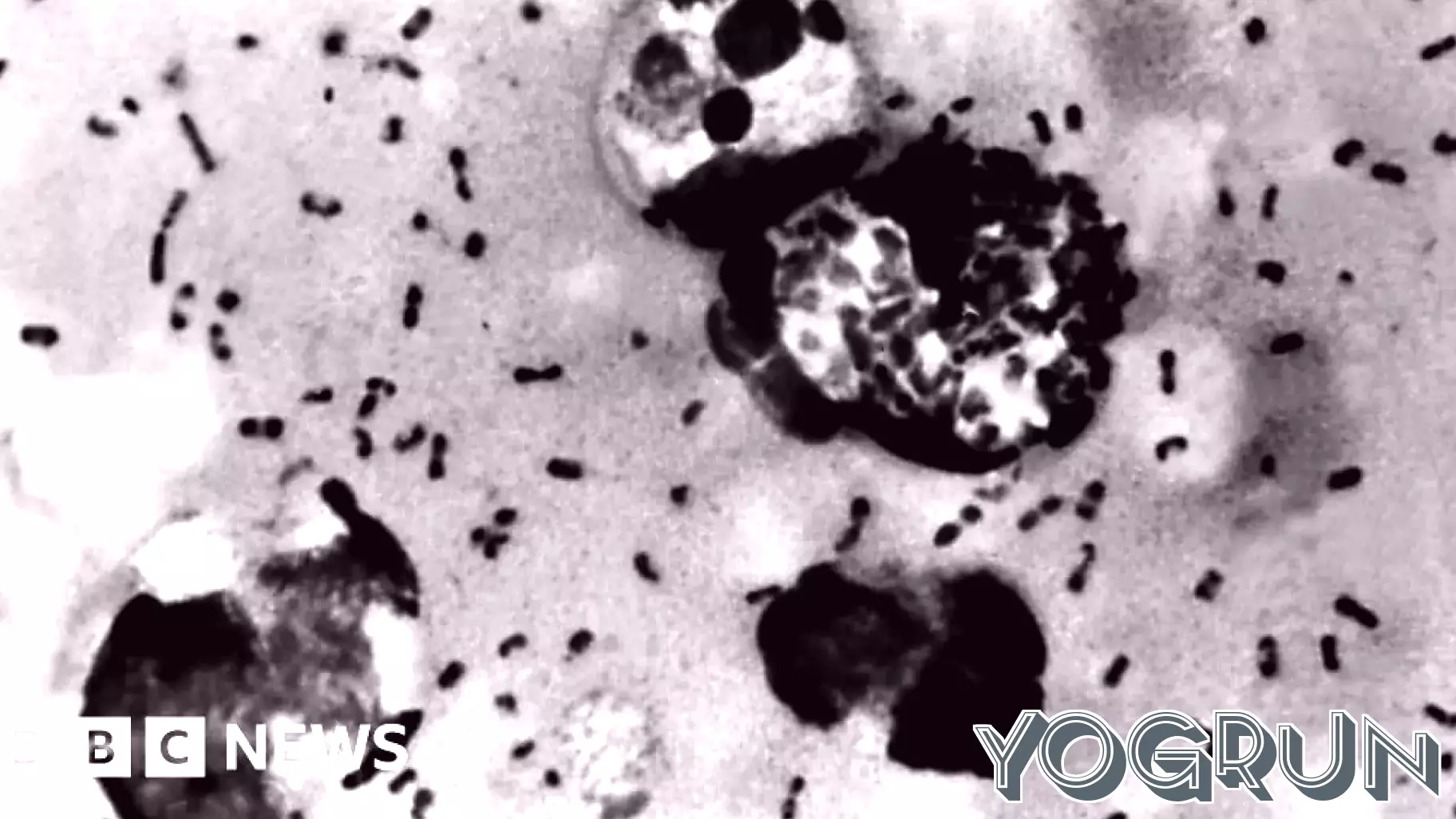 Plague Claims Life in Coconino County, Arizona