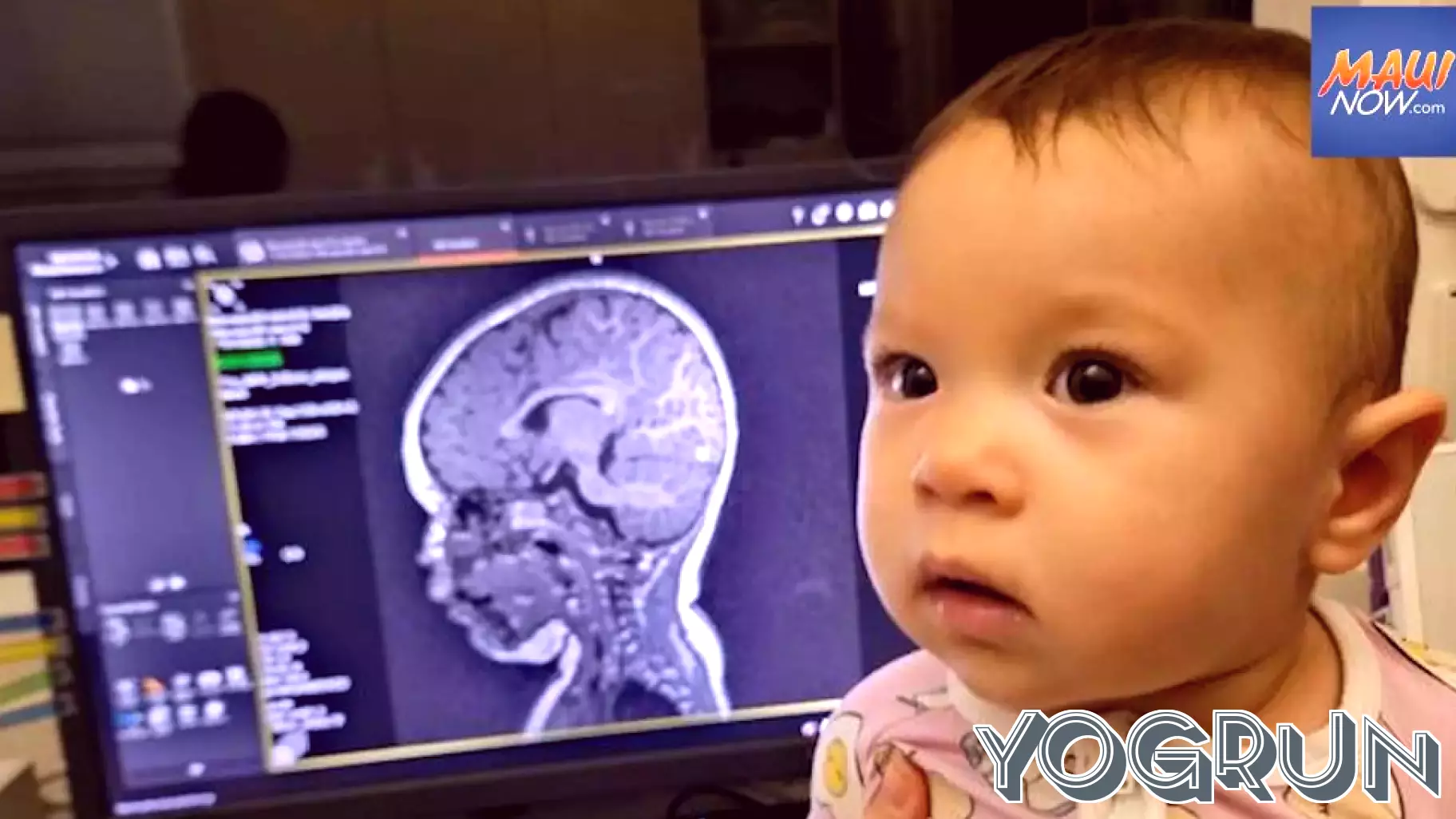 Study Links Microplastics to Infant Brain Development with New Funding