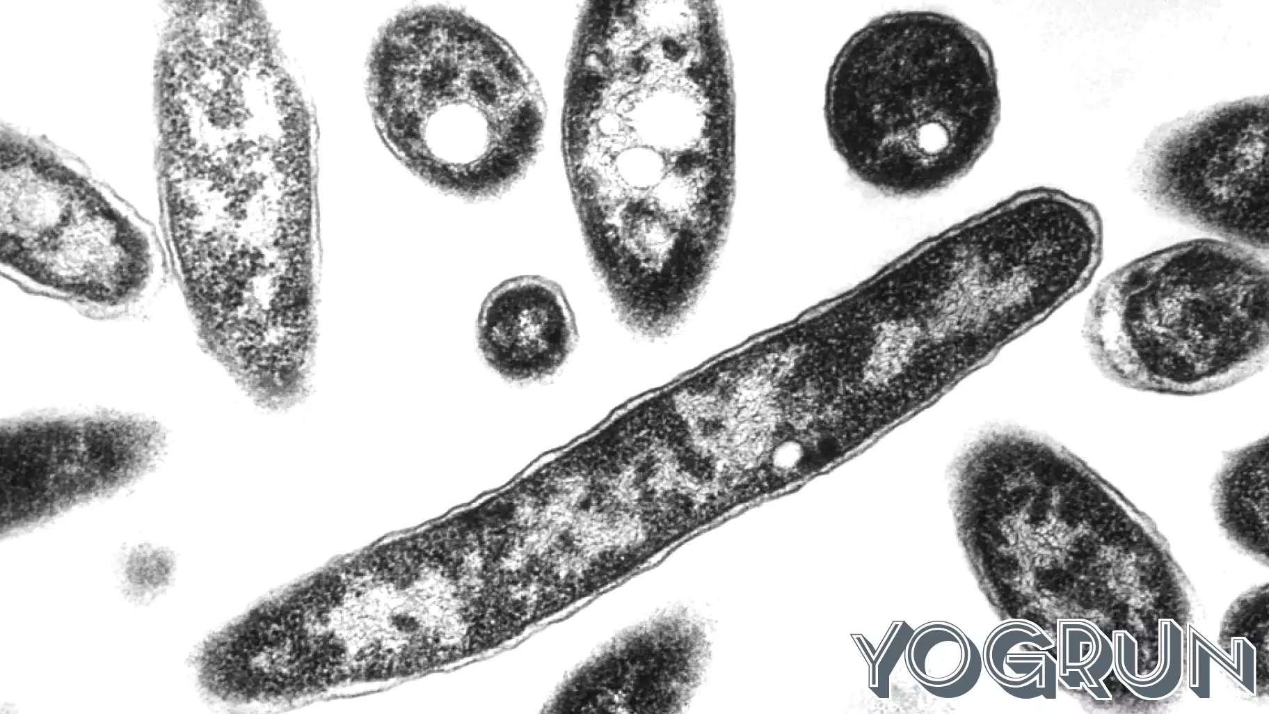Two stricken with Legionnaires Disease on Upper East Side, cluster investigated: NYC health officials