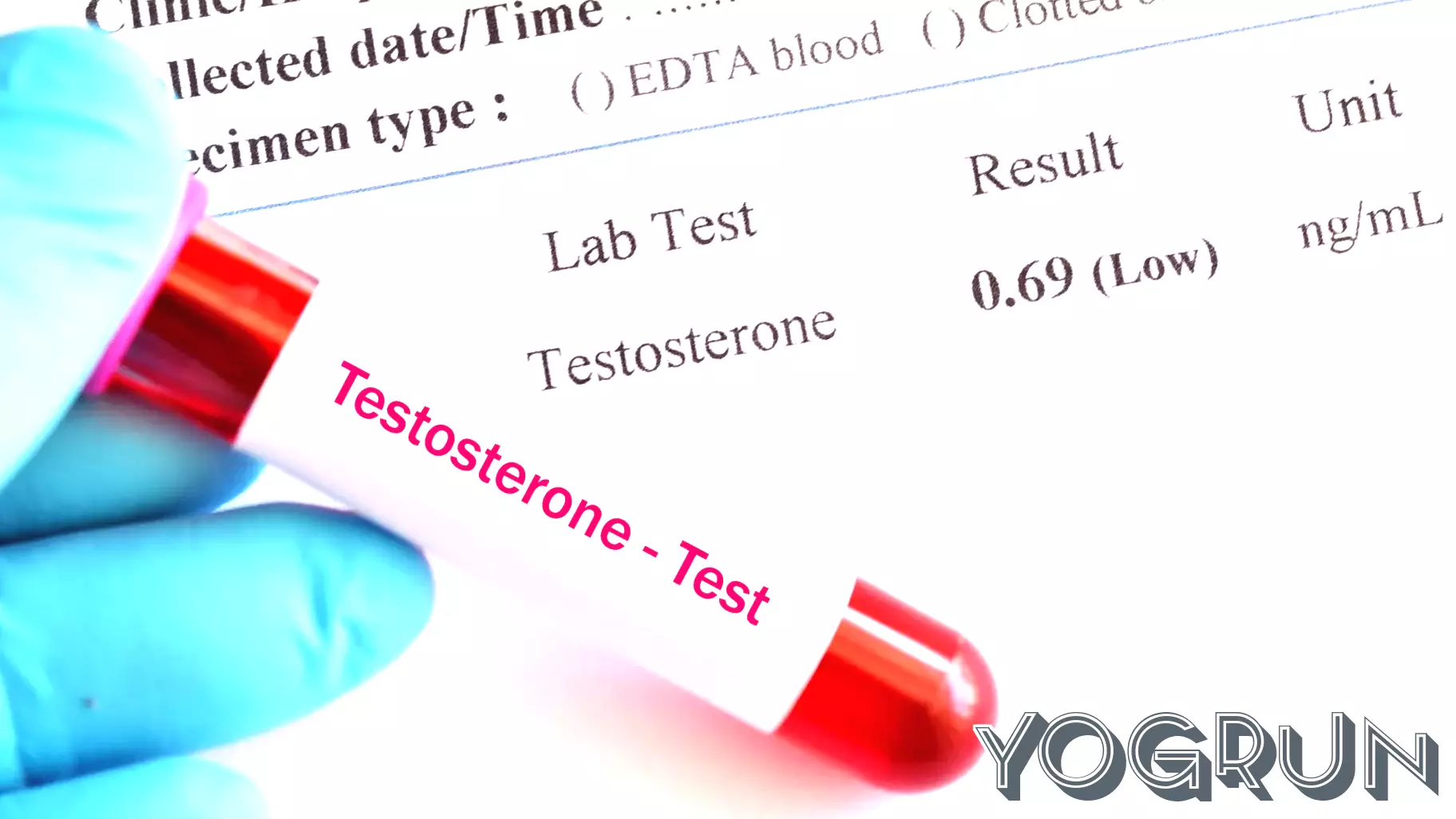 Who really needs testosterone?