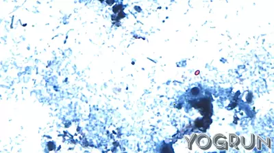 Does cooking or vinegar kill Cyclospora? How to avoid the diarrhea-causing parasite, according to health officials