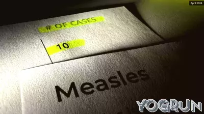 Health Officials Urge Vaccination Checks Amid Measles Outbreak