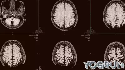 Healthcare Is AI’s Hardest Test