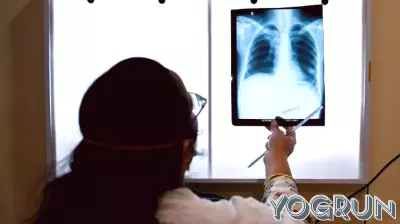 India Faces Challenges in Tuberculosis Elimination Efforts