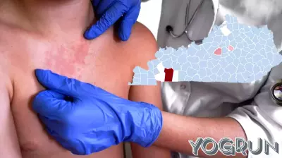 Kentucky measles cases rise to 24 as outbreak expands to new county