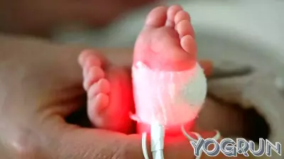 Millions of preterm births and thousands of infant deaths linked to plastic chemical