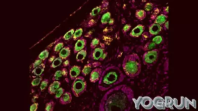 New Insights into Primate Ovarian Reserve Development by UCLA Scientists