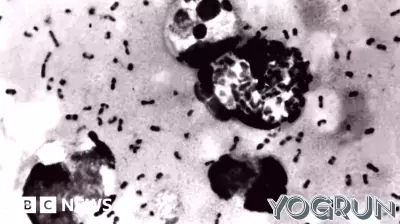 Plague Claims Life in Coconino County, Arizona