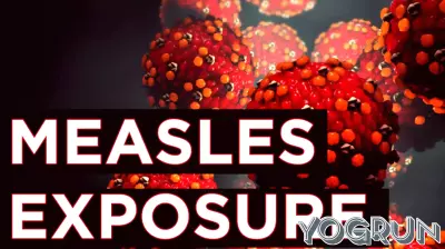 Warning Issued Over Potential Measles Exposure at Philadelphia Airport